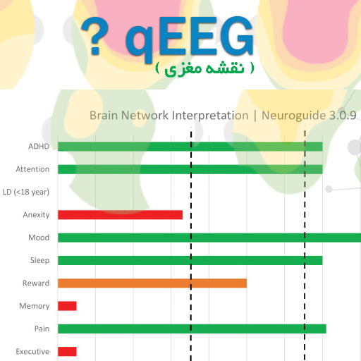 نقشه مغزی یا qEEG چه مواردی را نشان می دهد؟