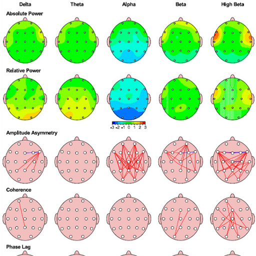 تفاوت نوروفیدبک و لورتا نوروفیدبک