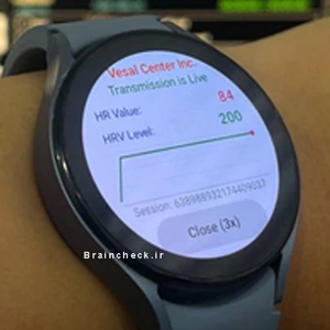 HRV یا تغییرپذیری ضربان قلب چیست؟ کاربرد و اهمیت آن در سلامت روان